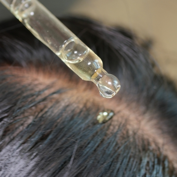 Hair Restoration (Men & Women)