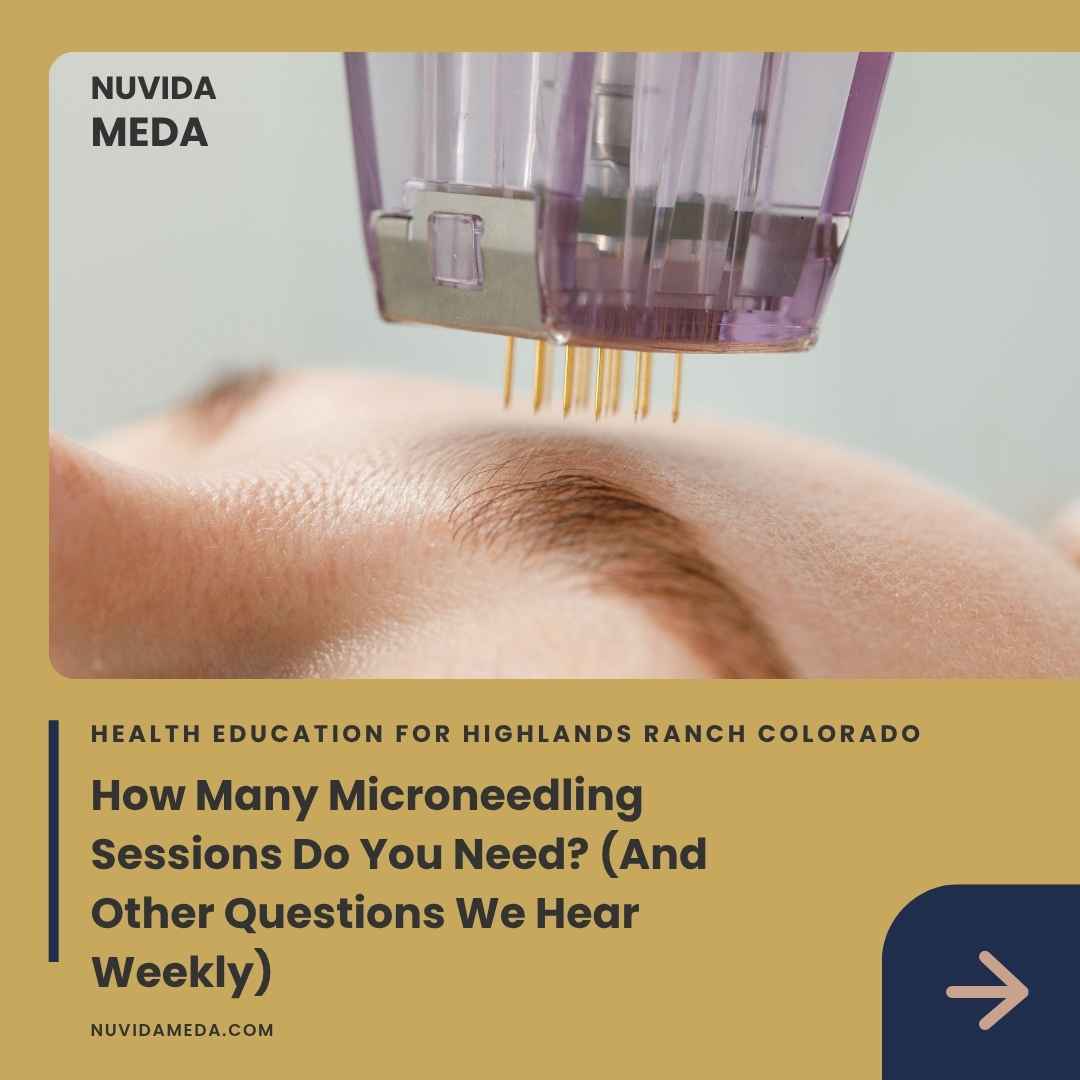 How Many Microneedling Sessions Do You Need? (And Other Questions We Hear Weekly)