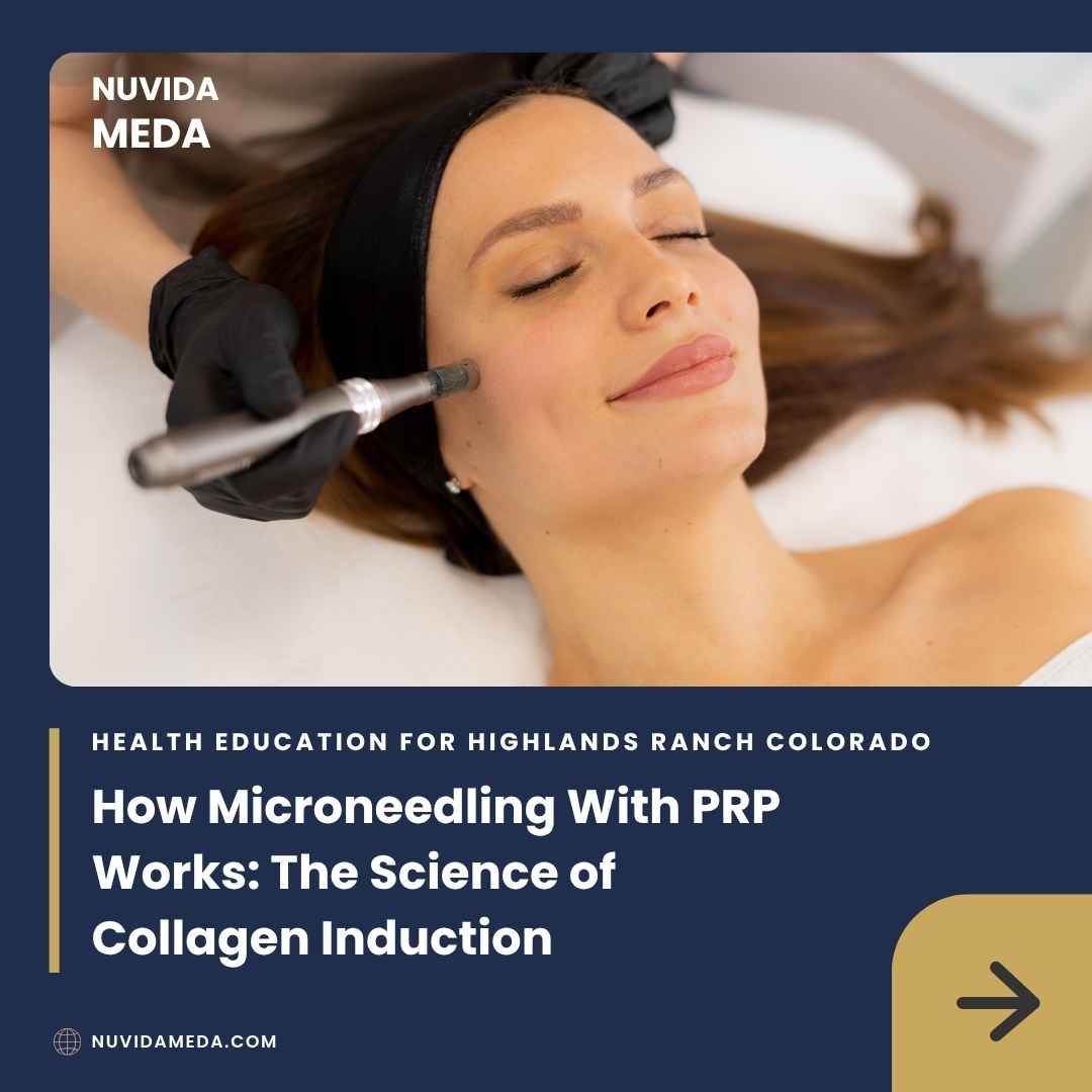 How Microneedling With PRP Works: The Science of Collagen Induction