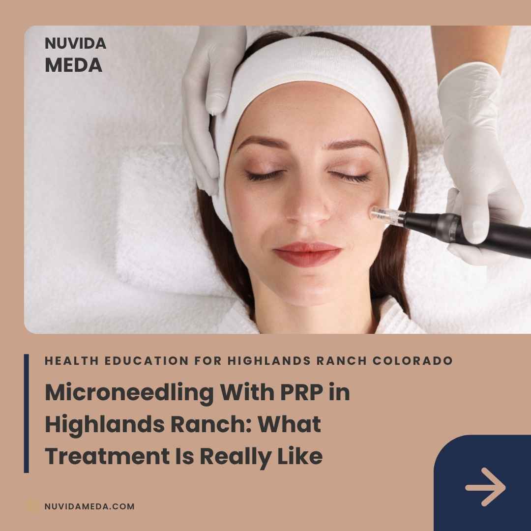 Microneedling With PRP in Highlands Ranch: What Treatment Is Really Like